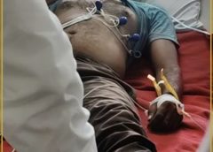 बिना सुरक्षा उपकरण पोल पर चढ़ाया, सफाईकर्मी को लगा करंट:टला बड़ा हादसा